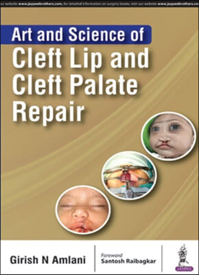 Art and Science of Cleft Lip and Cleft Palate Repair