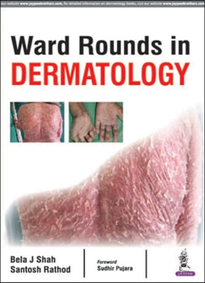 Ward Rounds in Dermatology