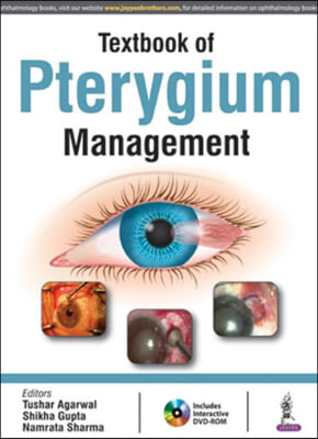 Textbook of Pterygium Management