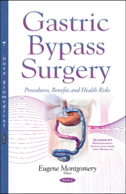 Gastric Bypass Surgery