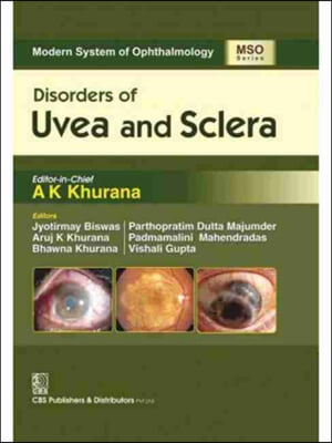 Disorders of Uvea and Sclera