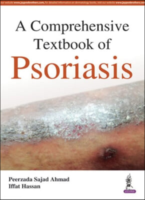 A Comprehensive Textbook of Psoriasis