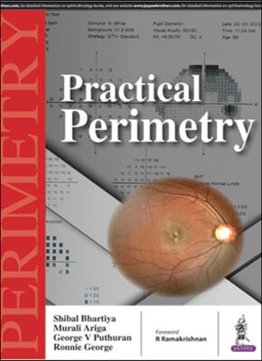 Practical Perimetry