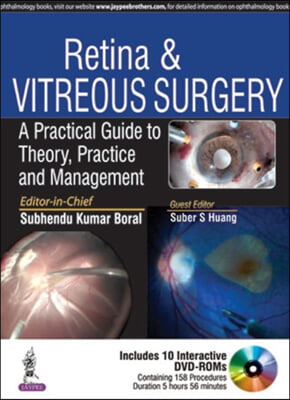 Retina & Vitreous Surgery: A Practical Guide to Theory, Practice and Management