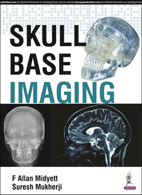 Skull Base Imaging