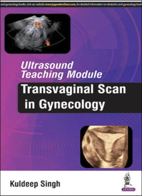 Ultrasound Teaching Module: Transvaginal Scan in Gynecology