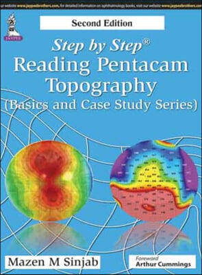 Step by Step Reading Pentacam Topography