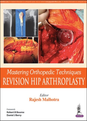 Mastering Orthopedic Techniques: Revision Hip Arthroplasty