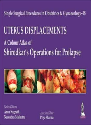 Uterus Displacements