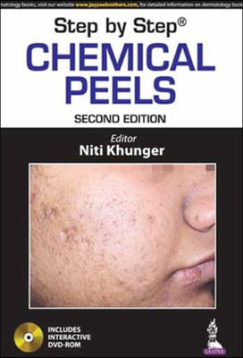 Step by Step: Chemical Peels