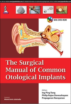 The Surgical Manual of Common Otological Implants