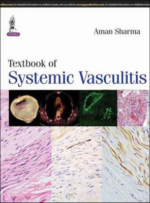 Textbook of Systemic Vasculitis