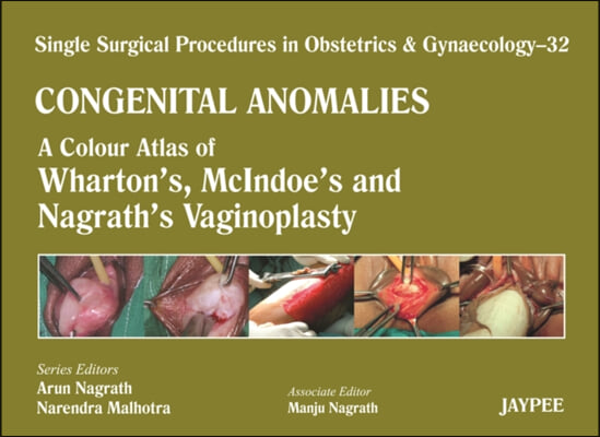 Single Surgical Procedures in Obstetrics and Gynaecology: Volume 32: Congenital Anomalies: A Colour Atlas of Wharton's, McIndoe's and Nagrath's Vagino