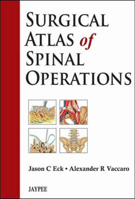 Surgical Atlas of Spinal Operations