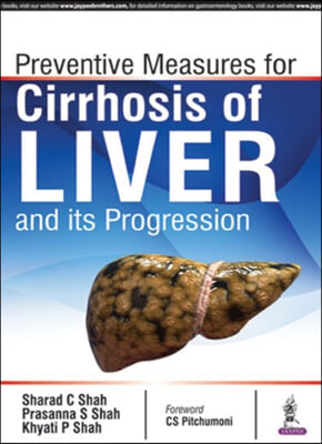 Prevention Measures for Cirrhosis of Liver and Its Progression