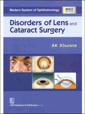 Disorders of Lens and Cataract Surgery