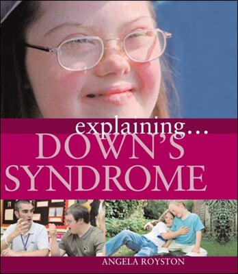 Explaining... Down&#39;s Syndrome