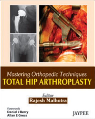 Total Hip Arthroplasty