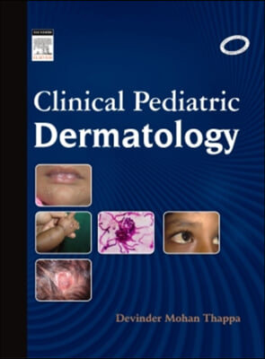 Clinical Pediatric Dermatology