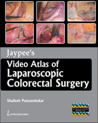 Jaypee&#39;s Video Atlas of Laparoscopic Colorectal Surgery