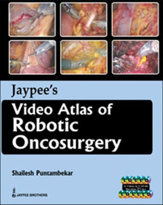 Jaypee&#39;s Video Atlas of Robotic Oncosurgery