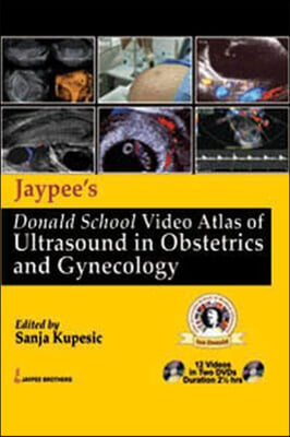 Jaypee&#39;s Donald School Video Atlas of Ultrasound in Obstetrics and Gynecology