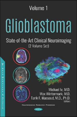 Glioblastoma