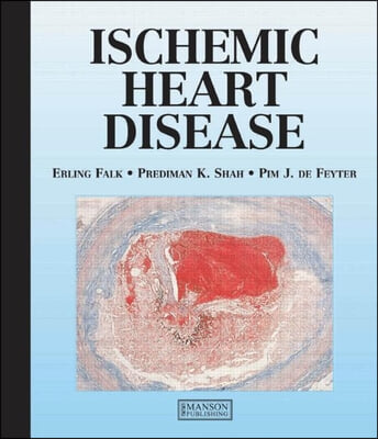 Ischemic Heart Disease