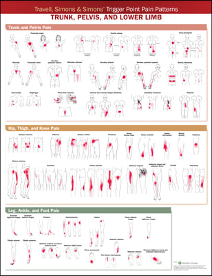 Travell, Simons &amp; Simons&#39; Trigger Point Pain Patterns Wall Chart