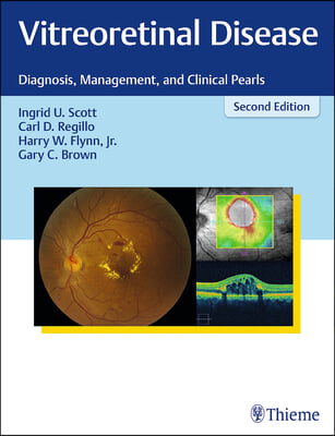 Vitreoretinal Disease: Diagnosis, Management, and Clinical Pearls