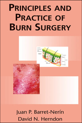 Principles and Practice of Burn Surgery