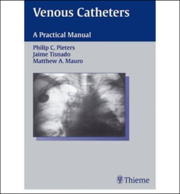 Venous Catheters: A Practical Manual