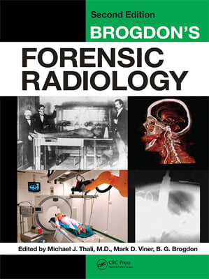 Brogdon&#39;s Forensic Radiology