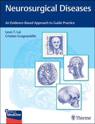 Neurosurgical Diseases: An Evidence-Based Approach to Guide Practice