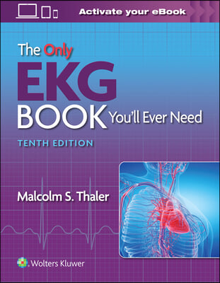 The Only EKG Book You&#39;ll Ever Need