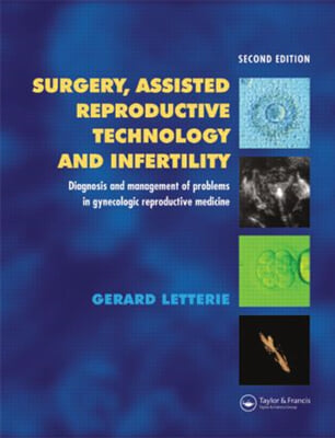 Surgery, Assisted Reproductive Technology and Infertility