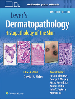 Lever&#39;s Dermatopathology: Histopathology of the Skin