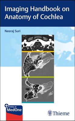 Imaging Handbook on Anatomy of Cochlea