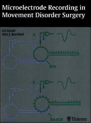 Microelectrode Recording in Movement Disorder Surgery