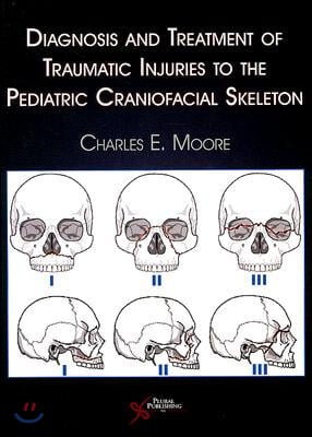 Diagnosis and Treatment of Traumatic Injuries to the Pediatric Craniofacial Skeleton