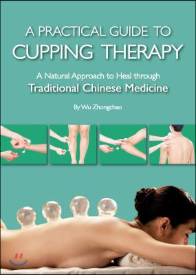 A Practical Guide to Cupping Therapy: A Natural Approach to Heal Through Traditional Chinese Medicine