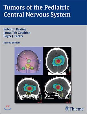 The Tumors of the Pediatric Central Nervous System