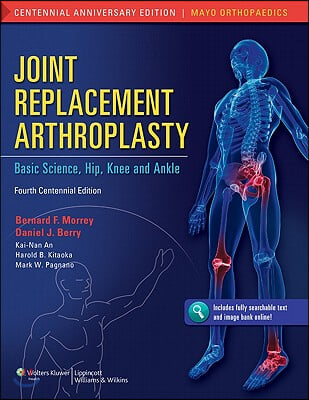 Joint Replacement Arthroplasty: Basic Science, Hip, Knee, and Ankle Volume 2