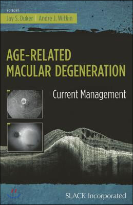 Age-Related Macular Degeneration