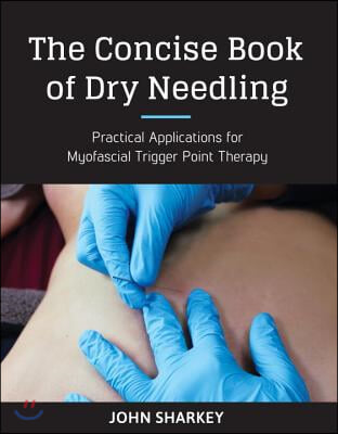 The Concise Book of Dry Needling