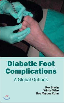 Diabetic Foot Complications: A Global Outlook