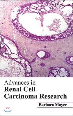 Advances in Renal Cell Carcinoma Research