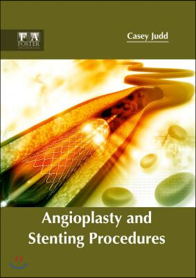 Angioplasty and Stenting Procedures