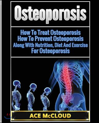 Osteoporosis: How To Treat Osteoporosis: How To Prevent Osteoporosis: Along With Nutrition, Diet And Exercise For Osteoporosis