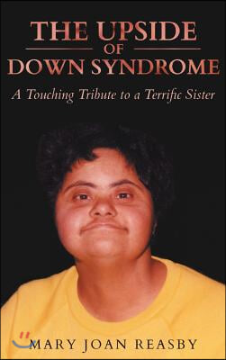 The Upside of Down Syndrome